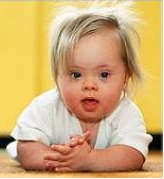 Infant with down's syndrome