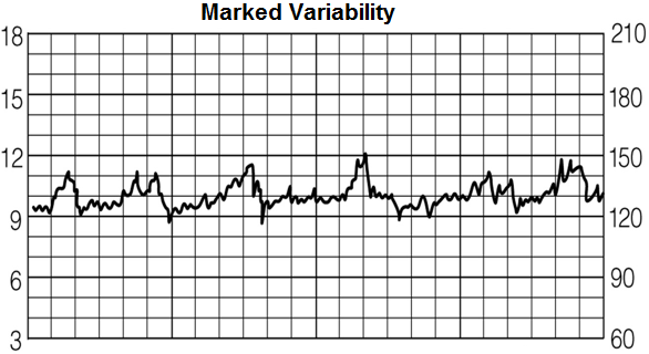 Marked variability
