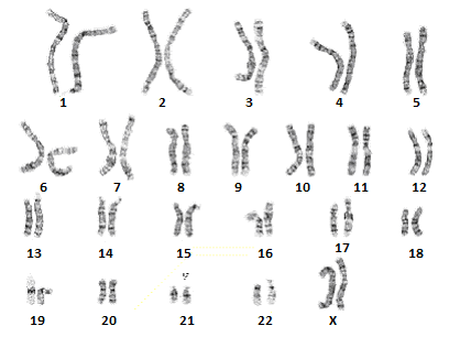 Karyotype of a normal, healthy individual