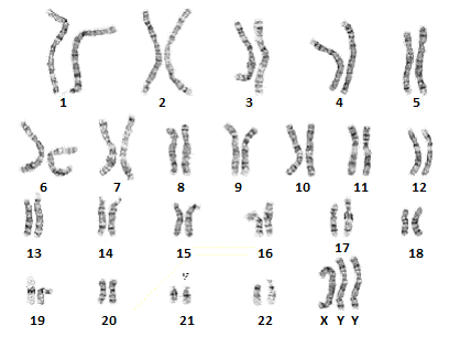 Supermale XXY karyotype